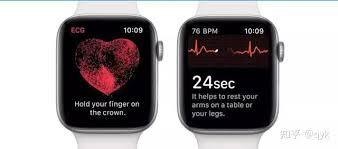 Apple Watch怎么查看心电图